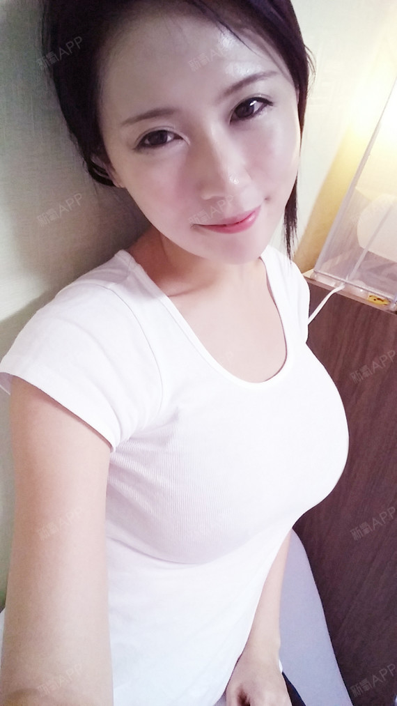 亿露飞假体隆胸术后第180天美丽日记_新氧整形