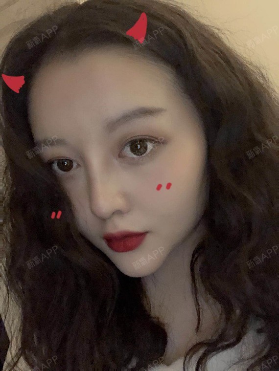 现在还没到1个月,我觉得我都已经恢复好了哈哈.