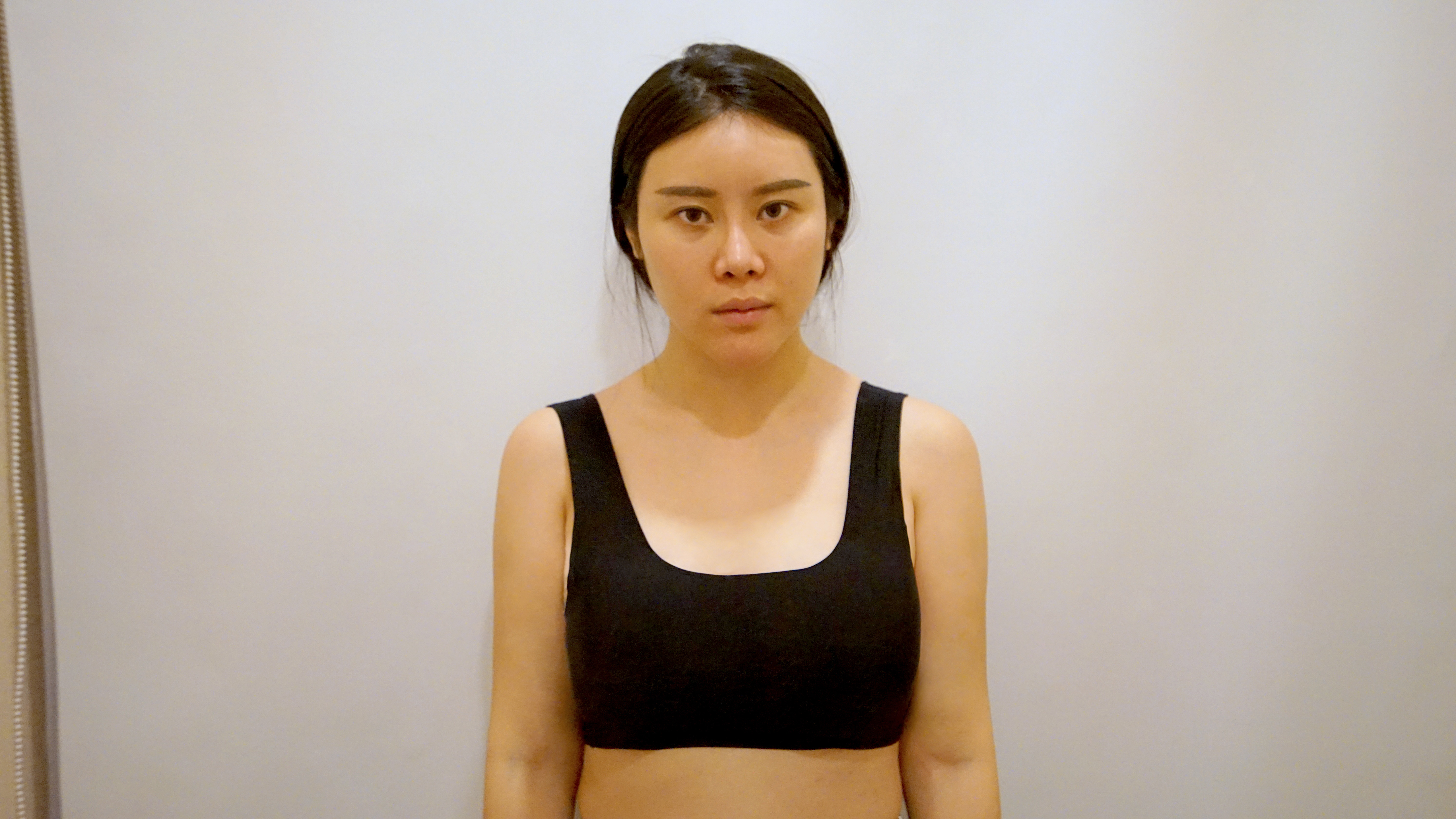 91隆胸十几二十年后会发生什么71049797现在_圈子-新氧美容