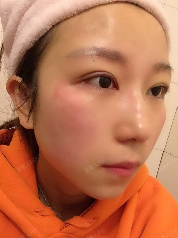 无远思近则切眉术第7天美丽日记