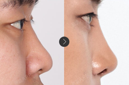 【菲斯莱茵整形faceline】男子整形,救活男性_圈子-新氧美容整形