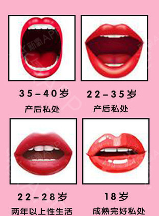 私密整形