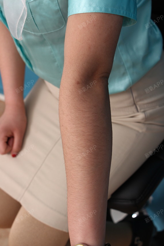 我手臂上的汗毛比较重,特别是离得近了,更显眼,平常_圈子-新氧美容