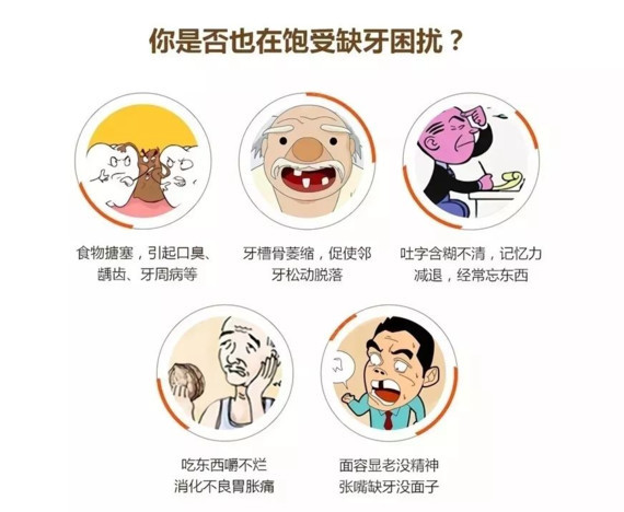 科普| 你真的瞭解缺牙的危害嗎?