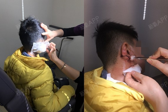 相比较大腿来说,耳朵的消毒会复杂很多.