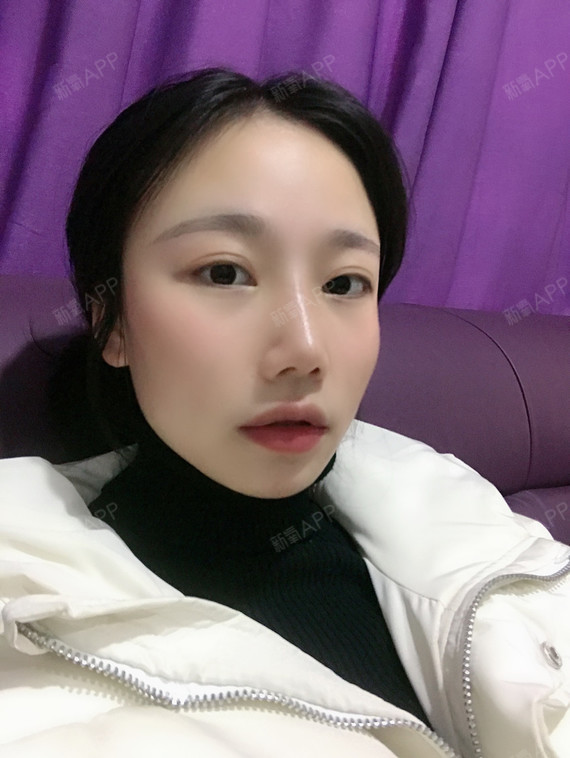 冬圆鼻综合第265天美丽日记