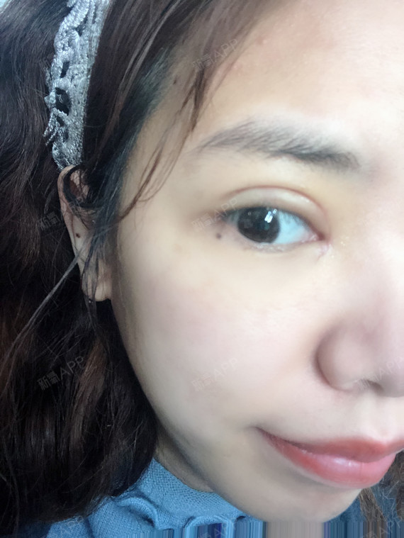 氧气zblzm眼部综合第10天美丽日记