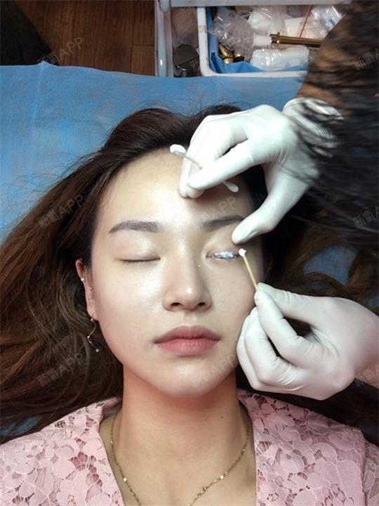 今天趁着休息就去做了一个美瞳线,因为这个天气真的是_圈子-新氧美容