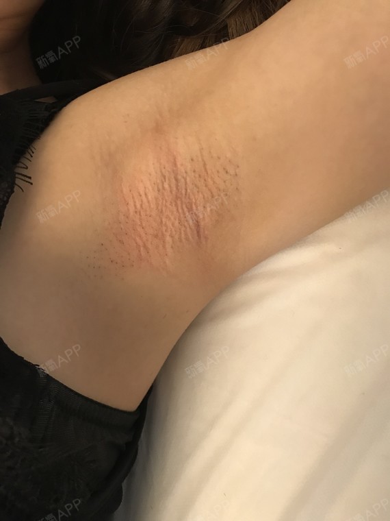 术后当自强