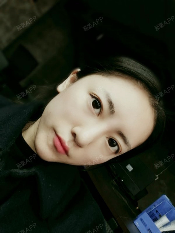 是陶子本人啦自体脂肪全脸填充第84天美丽日记