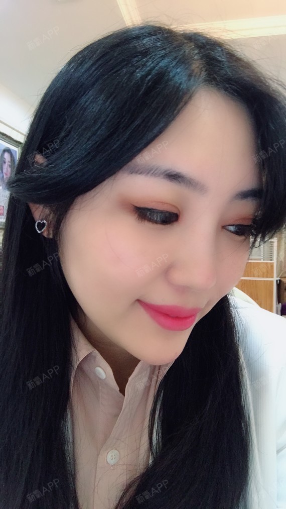 成都眼部多项好不好_效果图_丹凤00眼部多项术后第116天_新氧美容整形