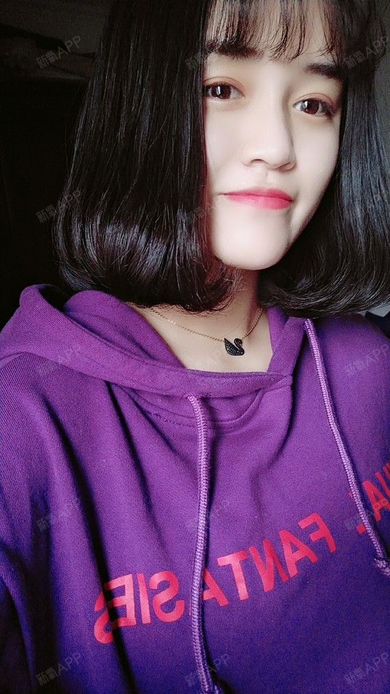 玻尿酸艾莉薇多少钱一支_艾莉薇玻尿酸好_玻尿酸艾莉薇图片