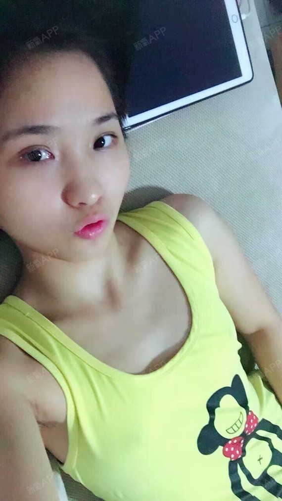 薇薇安的少女时代自体脂肪隆胸第0天美丽日记