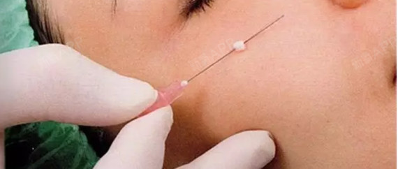 线雕用的线到底是什么线?分形状吗?不同形状对效果有影响吗?