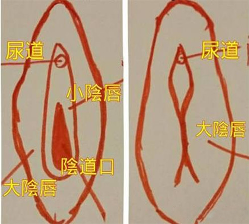 面对"小阴唇肥大"别说你无所谓!女性的"私处"如同_圈子-新氧美容整形