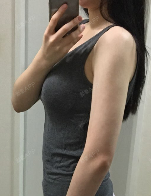 确实线条整理了很多胳膊细了很多