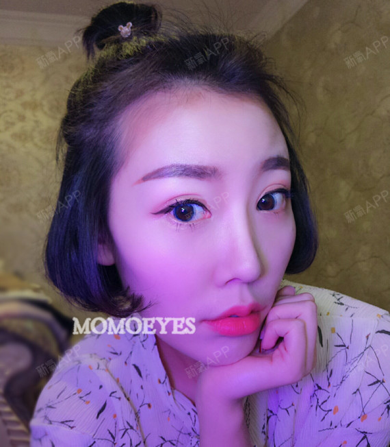 整形骨手术下颚多久恢复_整形骨手术下颚有硬块_下颚骨整形的手术