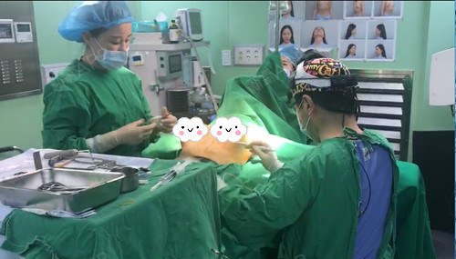 氧气达人陈米拉milla魔滴motive假体隆胸 膨体取出鼻修复手术过程直播