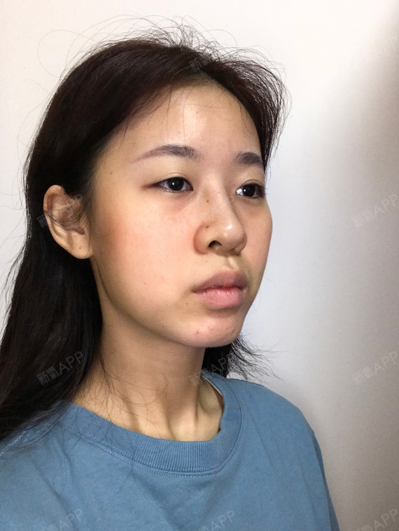 香港比较好的整形美容（香港比较好的整形美容医院） 香港比力
好的整形美容（香港比力
好的整形美容医院）《香港比利》 整形美容