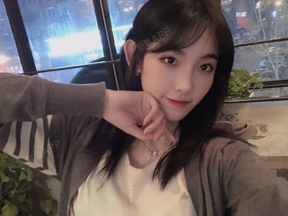 成都切开双眼皮好不好_效果图_氧气zo38c切开双眼皮术后第48天_新氧