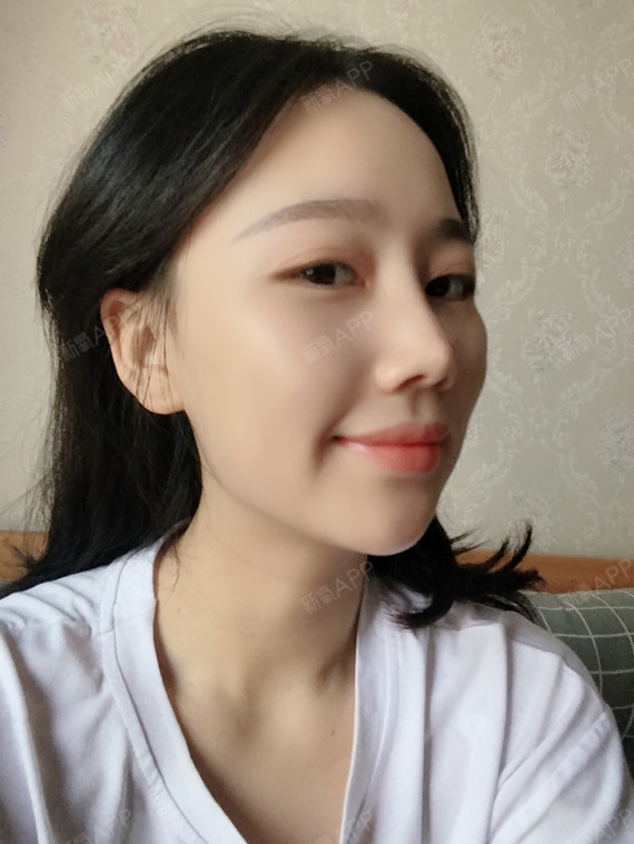 冬圆鼻综合第280天美丽日记