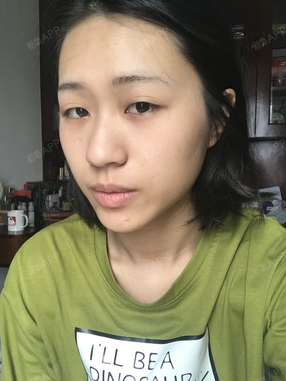 我的额头不够饱满 不仅仅不饱满 还有抬头纹呢