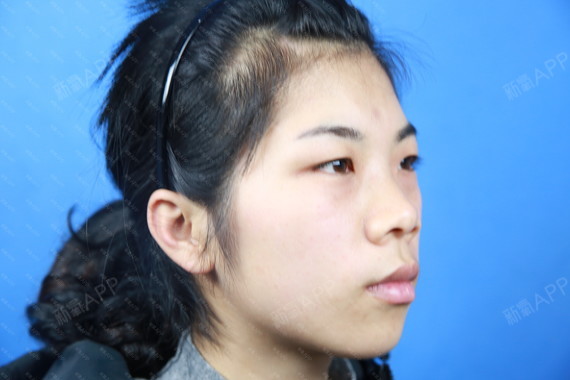 我鼻子基础很不好很矮而且短鼻子