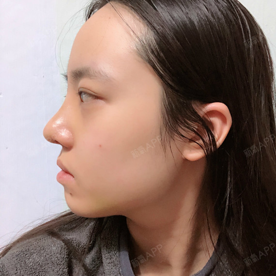 看看我的鼻子是不是超级好看侧面鼻子真的超级好看