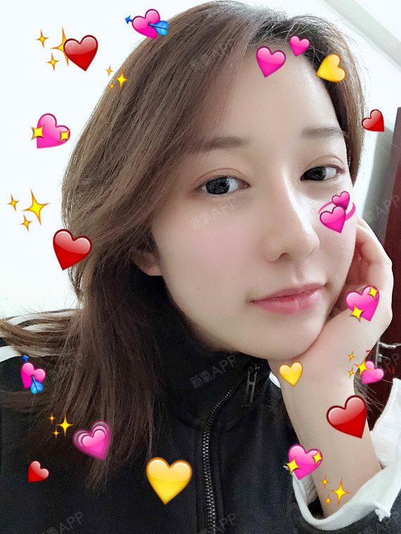 广州微针美塑好不好_效果图_权志龙的爱人微针美塑术后第302天_新氧