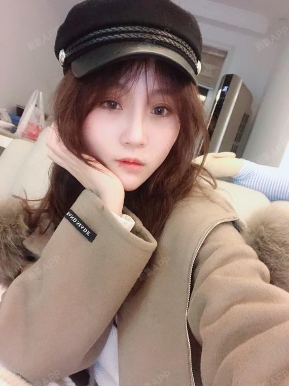 成都玻尿酸隆鼻好不好_效果图_氧气mtfd2fd玻尿酸隆鼻术后第10天_新氧