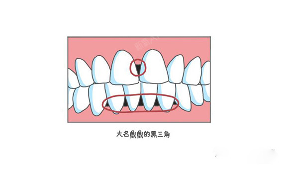 黑三角—这个杀手有点冷