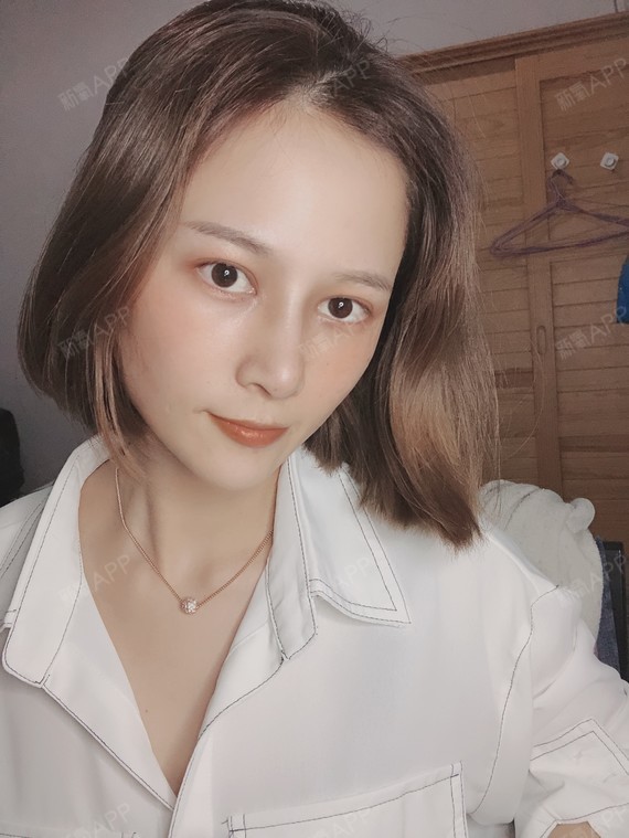 你是真的爱我吗自体软骨垫鼻尖第17天美丽日