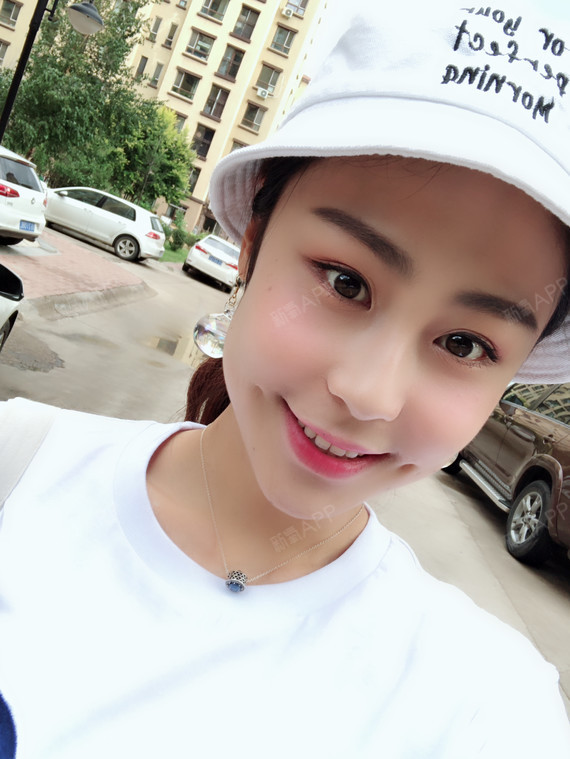嘿嘿嘿嘿恶化酒窝成形术第7天美丽日记-新氧美容整形