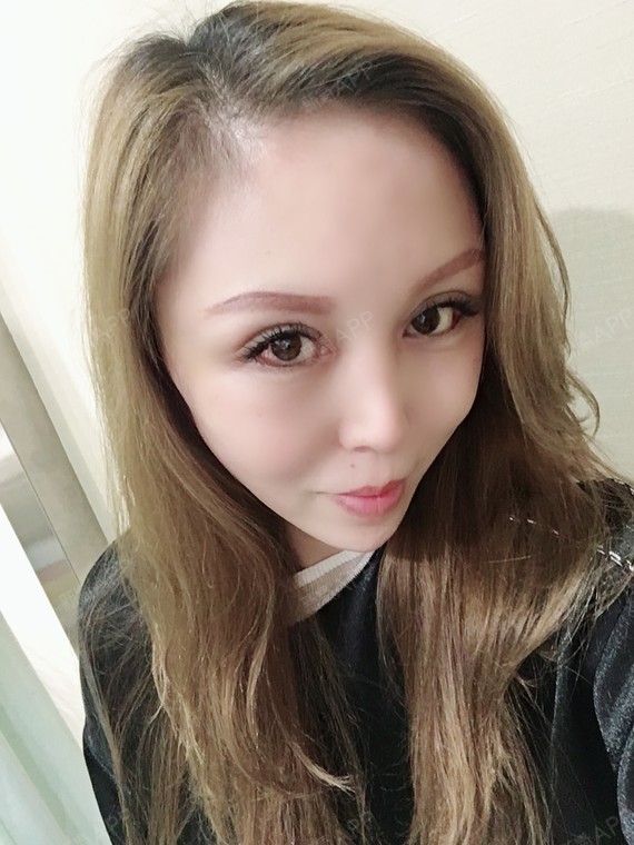 小切口手术提升好不好_效果图_眼部小丹丹小