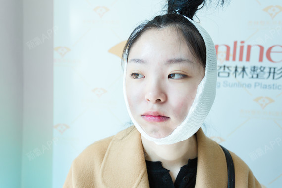 【沈阳杏林整形医院—下颌角整形】我的身材还算可以不_圈子-新氧美容