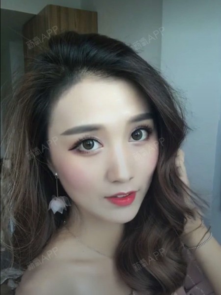 杭州童颜针好不好_效果图_刘雨涵涵美眉童颜针术后第241天_新氧美容