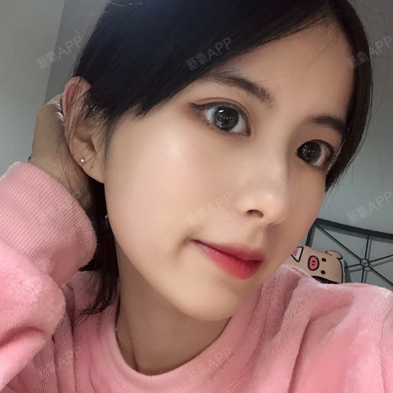 可以回家睡觉激光祛斑第30天美丽日记-新氧美