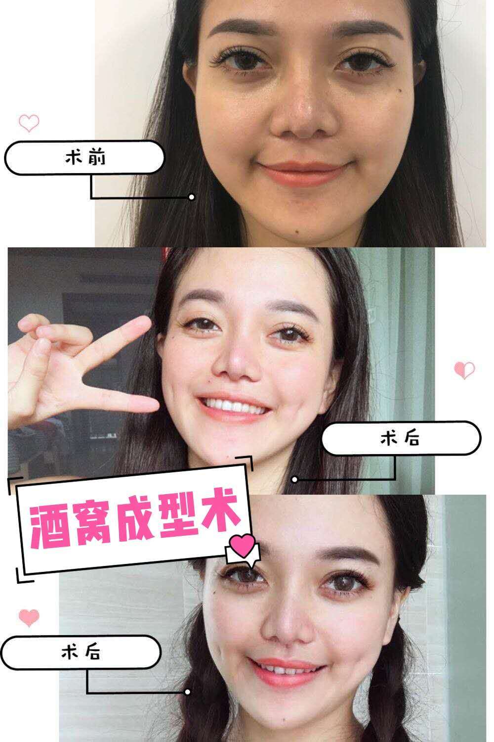 多个酒窝就成天使脸!梨涡浅笑迷死人