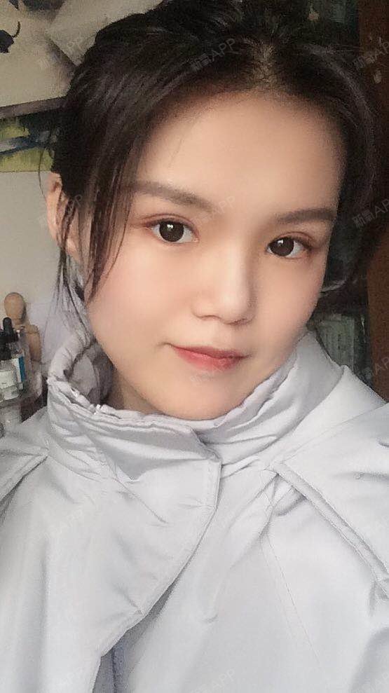 今天去医院拆线了,拆完线出来准备走的时候看到一妹