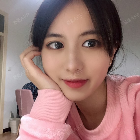 可以回家睡觉激光祛斑第30天美丽日记-新氧美