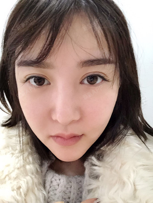 下颚前突/地包天