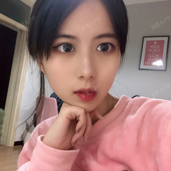 可以回家睡觉激光祛斑第30天美丽日记-新氧美