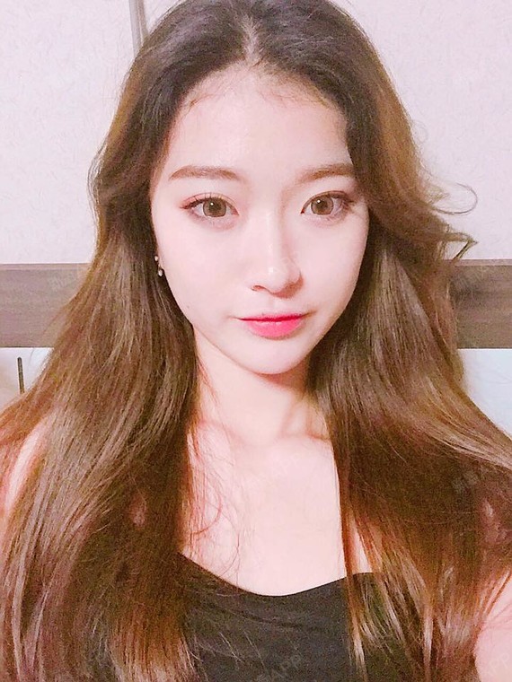 【苏州美贝尔—芭比小翘鼻】隆鼻术后26天了,鼻部形_圈子-新氧美容