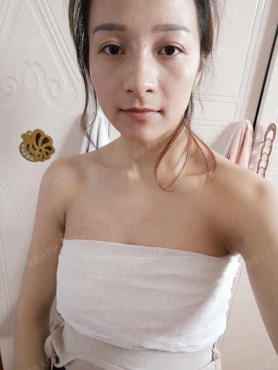 这几天乳房有肿_圈子-新氧美容整形