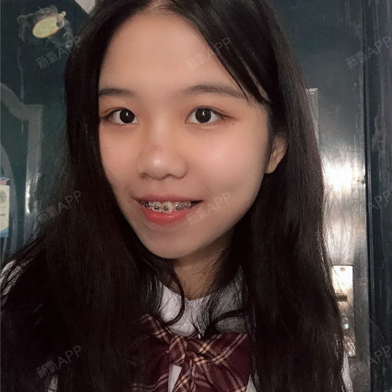 现在真的好了许多 确实真的很满意 继续努力啊 牙套妹