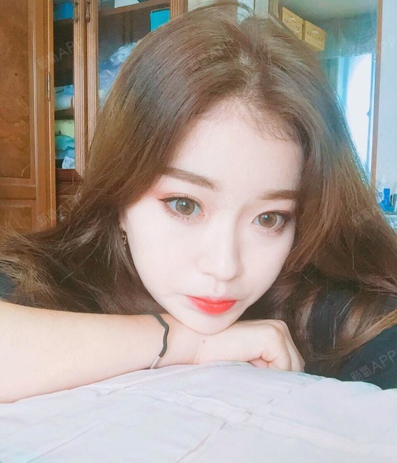 【苏州美贝尔—芭比小翘鼻】隆鼻术后26天了,鼻部形_圈子-新氧美容