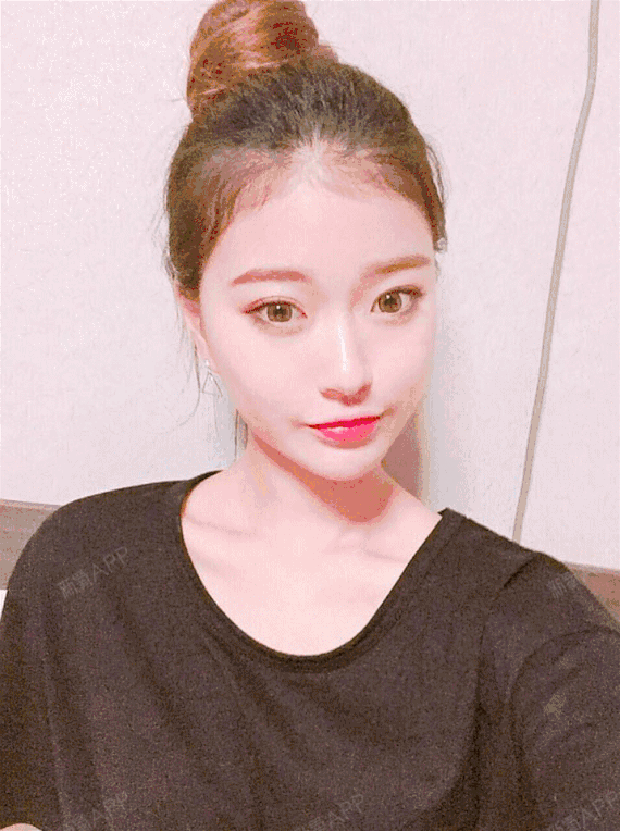 【苏州美贝尔—芭比小翘鼻】隆鼻术后26天了,鼻部形_圈子-新氧美容