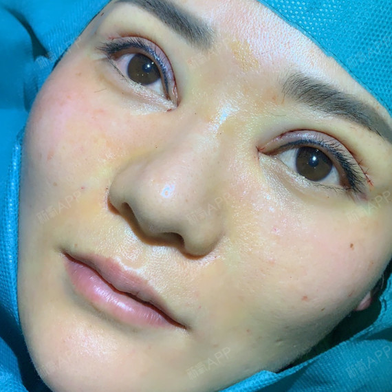 院做项目的时候,看到了一位好长时间没见的姐妹_圈子-新氧美容整形