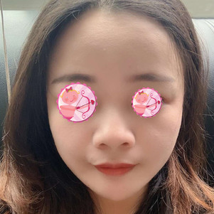 刚打完瘦脸针,不疼,刚开始打咬肌有点酸.