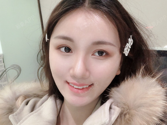 双子座李幂隐形矫正第70天美丽日记-新氧美容